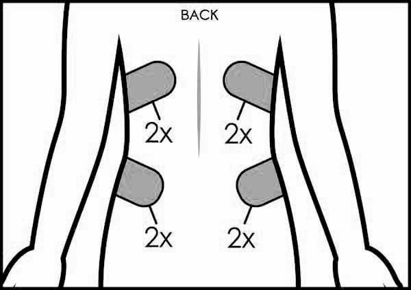 CoolSculpting Treatment Area: Back (above & below waist)