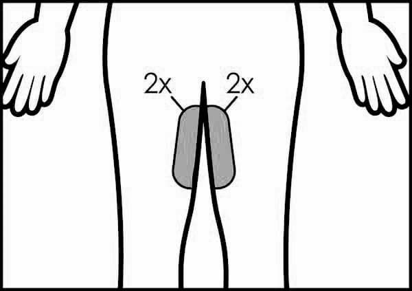 CoolSculpting Treatment Area: Inner Thighs
