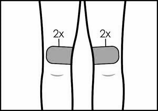 CoolSculpting Treatment Area: Above the Knees