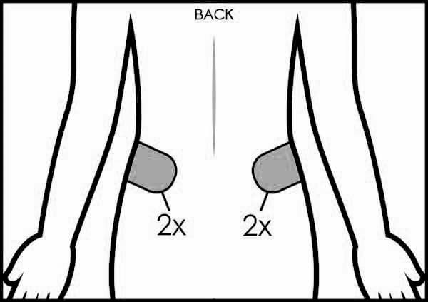 CoolSculpting Treatment Area: Love Handles