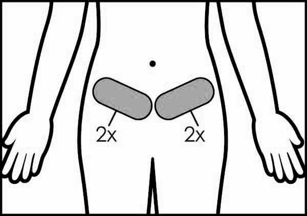 CoolSculpting Treatment Area: Lower Abs