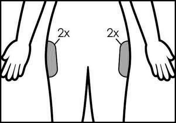 CoolSculpting Treatment Area: Outer Thighs