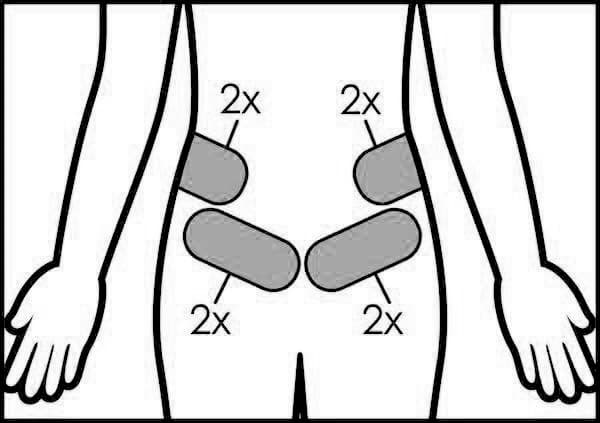 CoolSculpting Treatment Area: Waistline