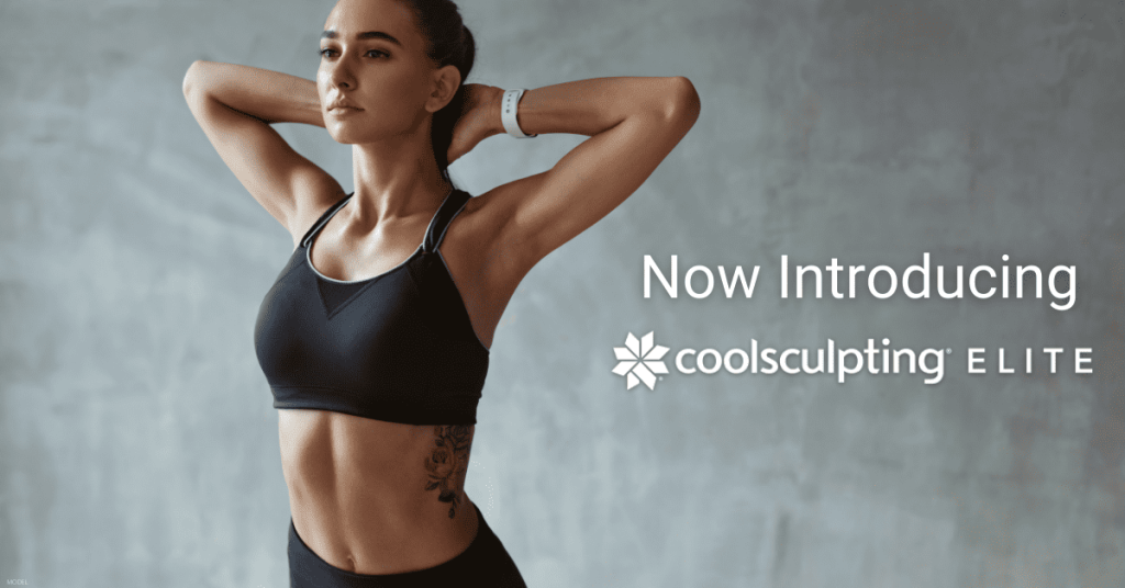 A woman poses after getting several CoolSculpting® treatments.