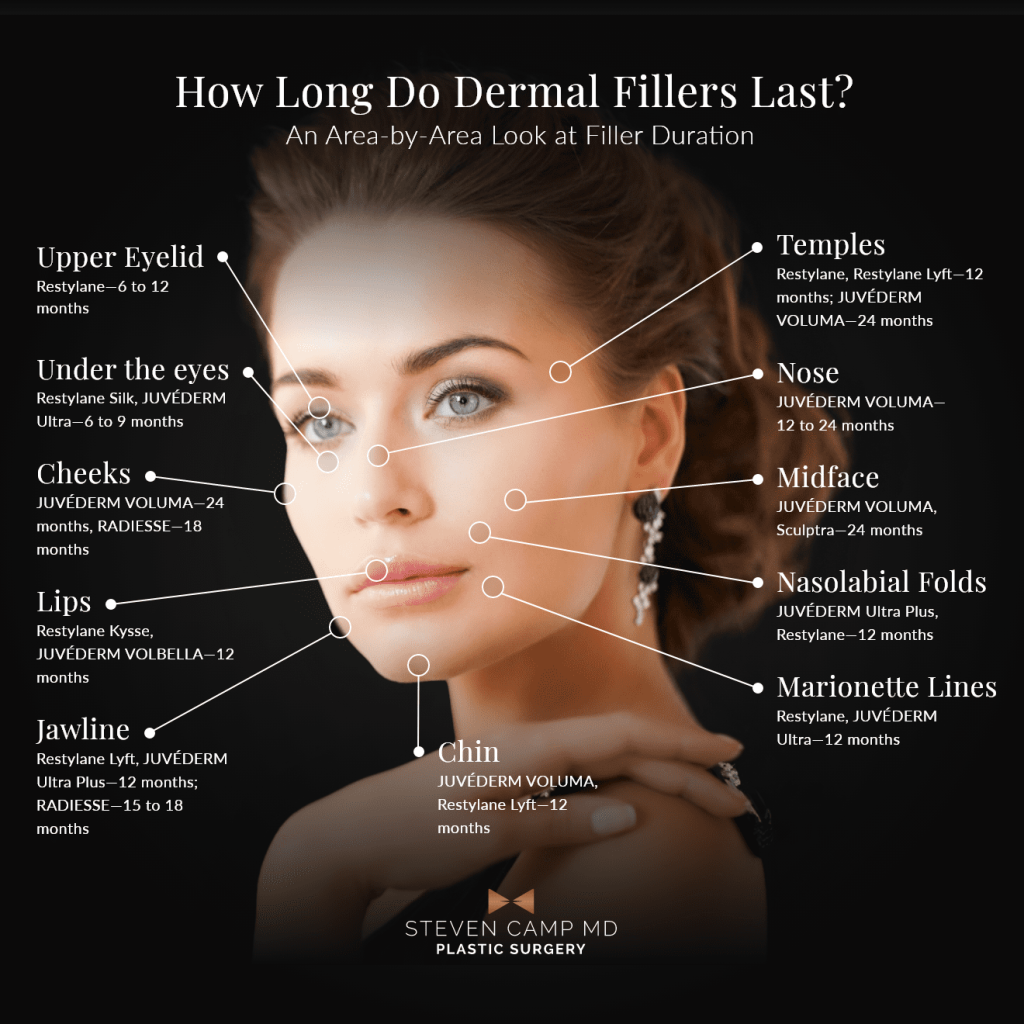 How long do dermal fillers last graphic