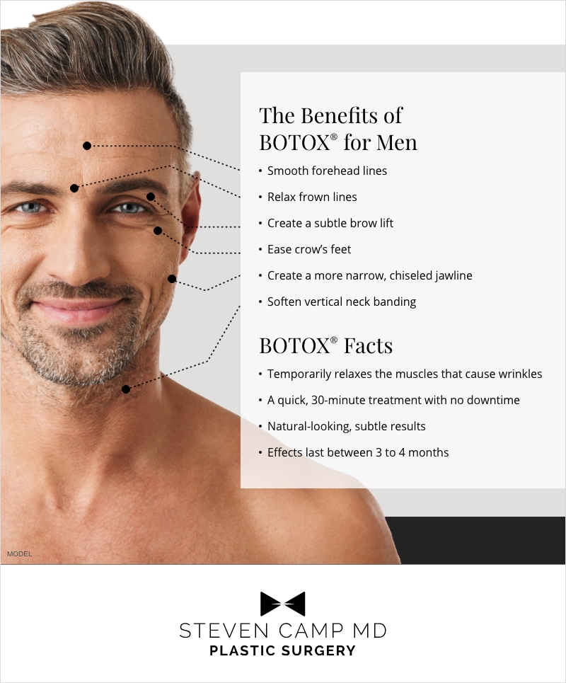 The benefits of BOTOX for men (infographic)