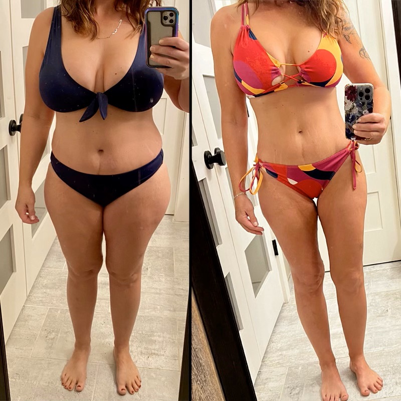 Real patient results: one of our patients before and after GLP-1 medication