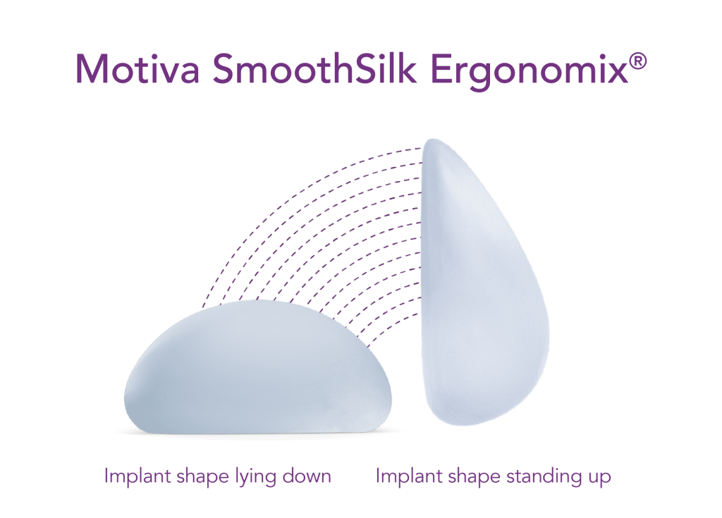 Motiva SmoothSilk Ergonomix breast implant profile