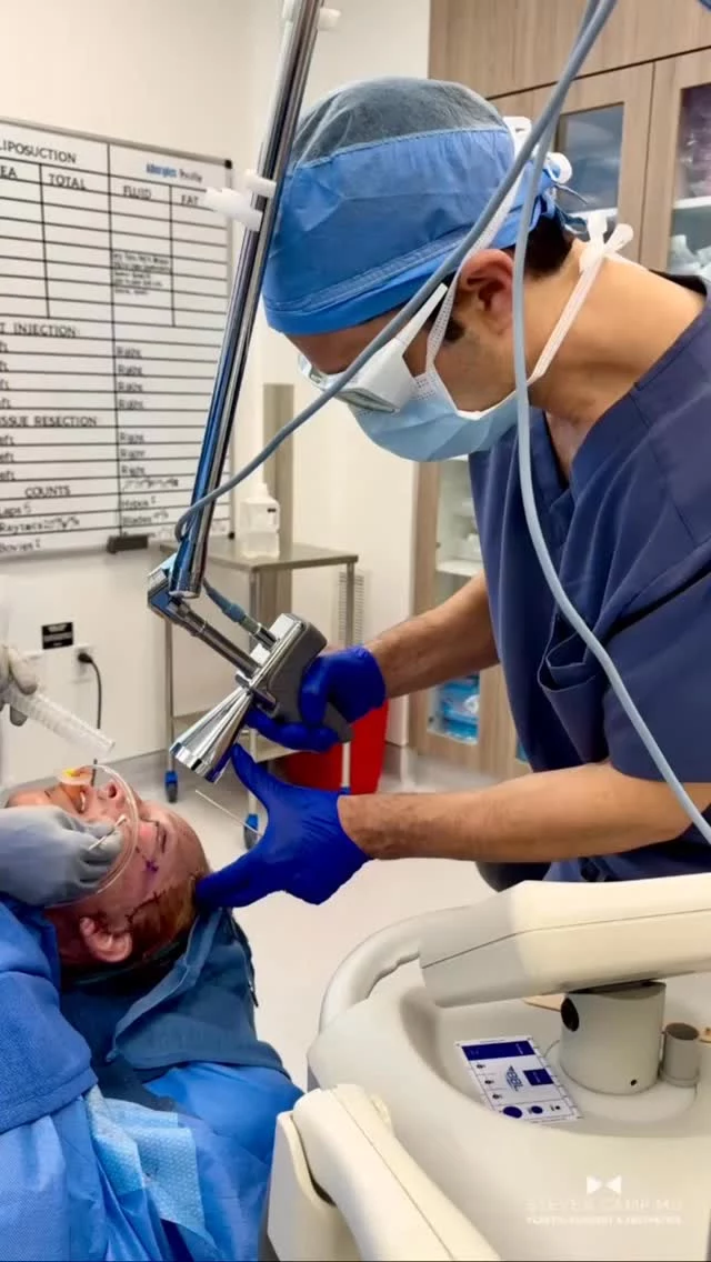 What’s better than CO2?
#Erbium laser resurfacing. 

CO₂ lasers have long been the standard—but technology evolves. Erbium laser resurfacing delivers comparable (often superior) results with less heat, less downtime, and a lower risk of pigment changes.
It allows me to precisely target deep lines and textural irregularities while preserving the surrounding skin—ideal for patients who want visible improvement without an extended recovery.
The goal isn’t just resurfacing—it’s refined, natural rejuvenation.
Considering treatment for deeper wrinkles? Let’s customize a plan that works for you.