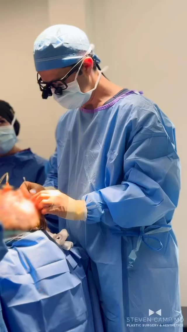 💉 Deep Plane vs. SMAS Facelift – What’s the real difference and why have I transitioned to this in my practice? 

Let’s talk about why I choose the deep plane technique. Hint: it’s not just trendy — it’s transformative.

The deep plane lift doesn’t just tighten skin. It repositions the underlying facial structures for a more natural, longer-lasting result. Less pulled. More you. And that I know is what you want. 

✨ Why I do deep plane:
✔️ Restores volume where it belongs
✔️ Minimizes tension on the skin = better scars
✔️ Ideal for midface, jowls, and neck in one elegant move
✔️ Allows me to be where I need to be with great visualization 

You deserve a result that looks like you, but refreshed.
Not windswept. Not overdone. Just right. This makes me feel like I am practicing what we preach in our Steven Camp MD Plastic Surgery Core Values and Mission Statement. In other words, we want to help you be you, just better than ever. 

🎥 Watch this video to understand the art behind the technique — and why it matters who’s holding the scalpel.

#facelift #facialrejuvination #deepplanefacelift #dfwplasticsurgeon #fortworthplasticsurgeon